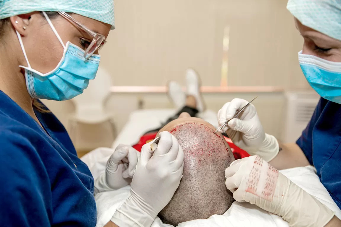 2 artsen die een FUE haartransplantatie uitvoeren bij een patiënt