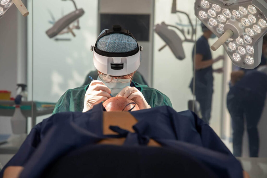 Een arts voert een haartransplantatie uit in een moderne kliniek, met focus op het nauwkeurig implanteren van haarzakjes bij een patiënt.